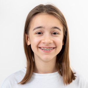 Young patient smiling with braces at an orthodontist in Monrovia