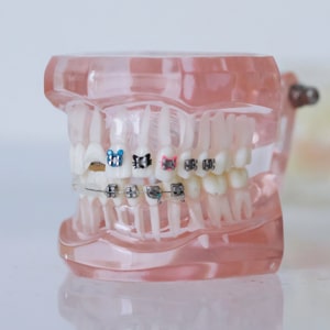 child orthodontics Monrovia