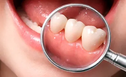 Deciduous Teeth